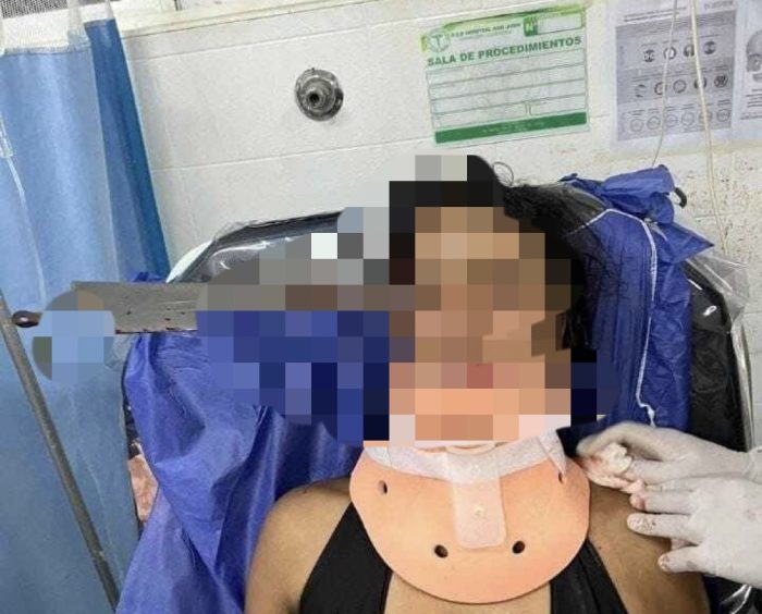 Jovem termina com facão cravado no rosto por causa do namorado “zé droguinha”; imagens fortes